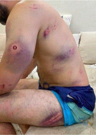 În presă au apărut fotografii în care se poate vedea starea fizică a persoanelor care au ajuns sub bastoanele și gloanțele de cauciuc, trase de reprezentanții organelor de forță