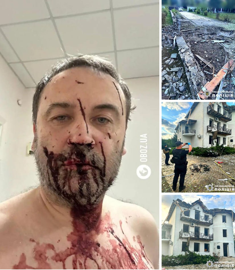 18+. Ilia Ponomarev, singurul deputat rus care a votat împotriva anexării Crimeei, rănit într-un atac cu drone la Kiev. Acesta locuiește din 2016 în Ucraina